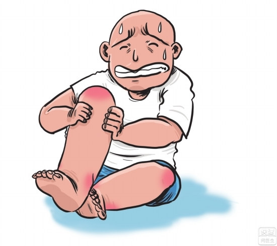 痛风和普通关节炎不是一回事
